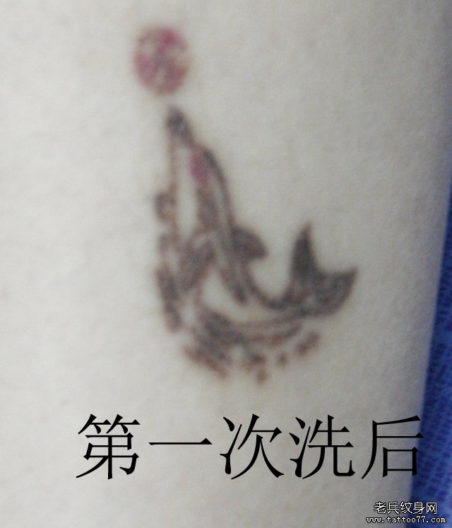激光洗纹身后对比效果案例由武汉专业洗纹身店带来
