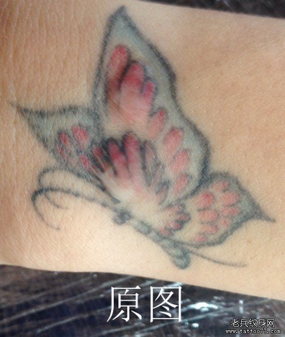 武汉最好的彩色蝴蝶激光洗纹身过程
