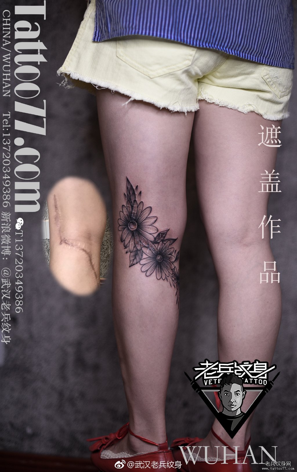 遮盖疤痕 腿部-北京京都墨客纹身工作室