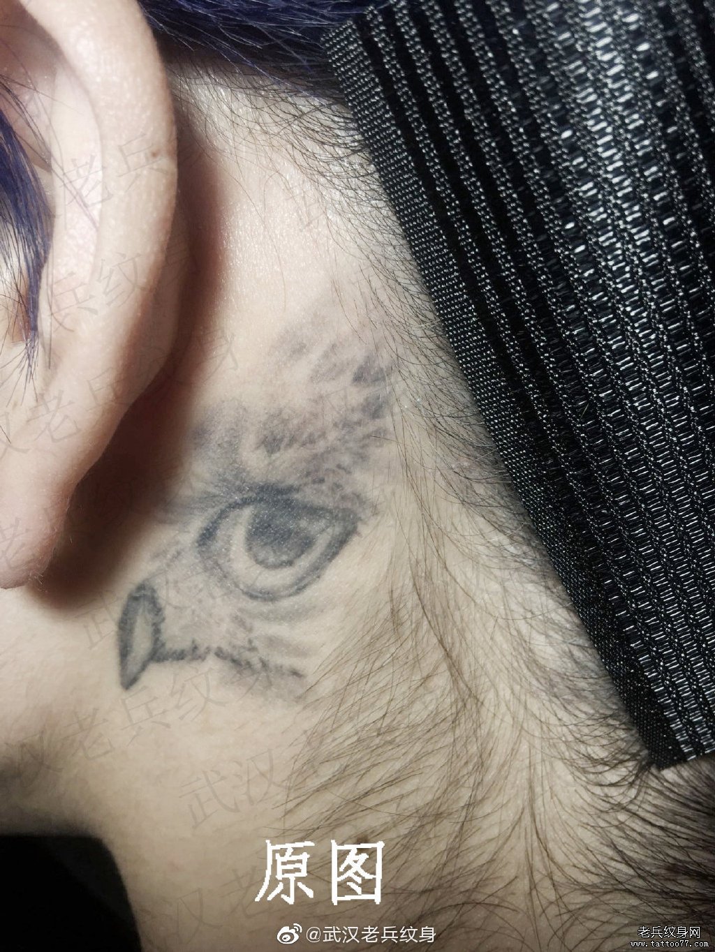 耳后老鹰皮秒洗纹身过程